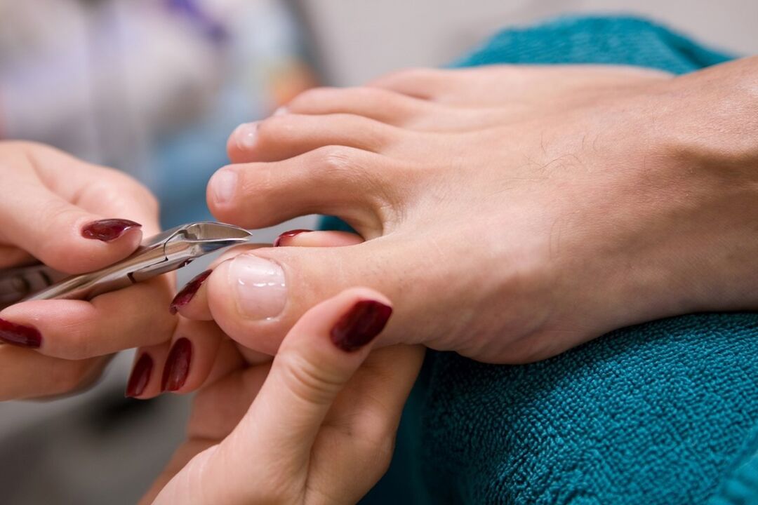 Pedicure as a means to infect nail fungus