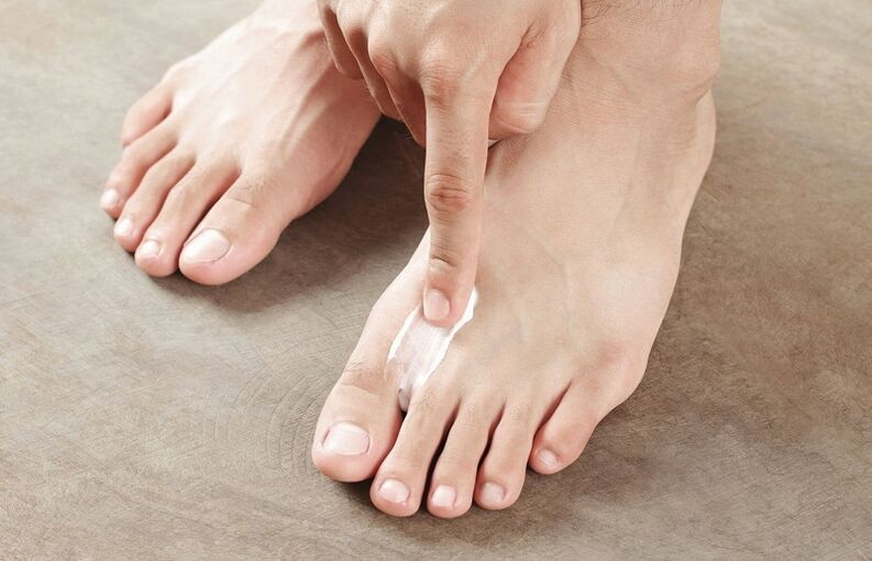 Ointment used to treat toenail fungus