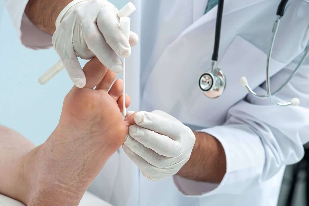 Examination for athlete's foot by a doctor