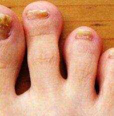 Nogs foot