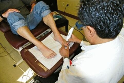 Laser nail fungus removal
