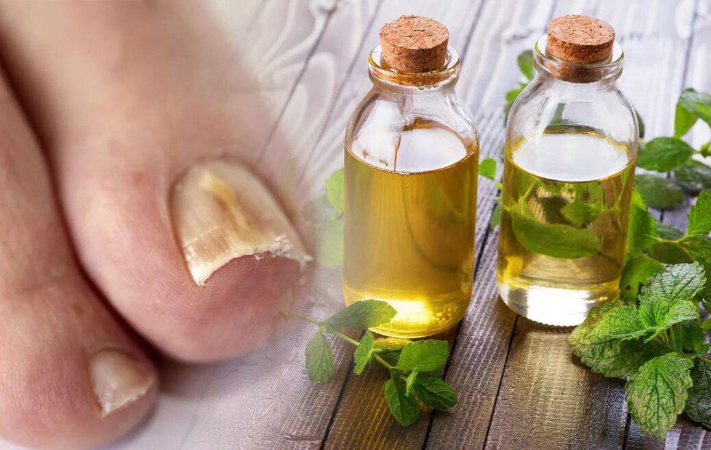 Vinegar against nail fungus