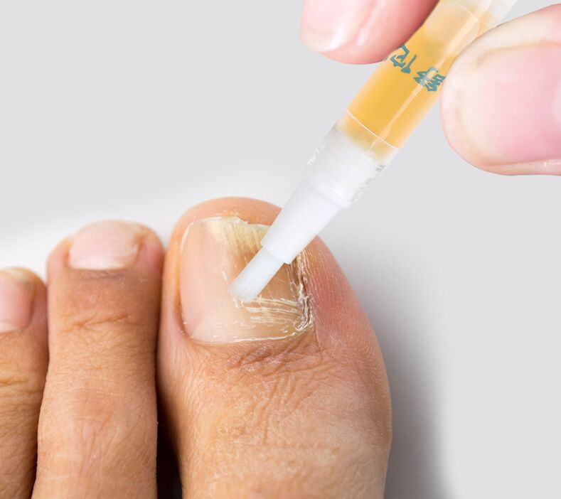 Liquid for toenail fungus